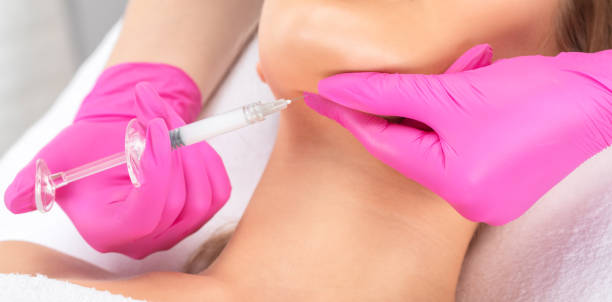 A Closer Look at Double Chin Liposuction